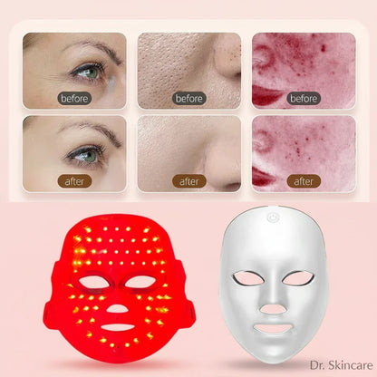 Advanced 7-Color Clinical LED Mask