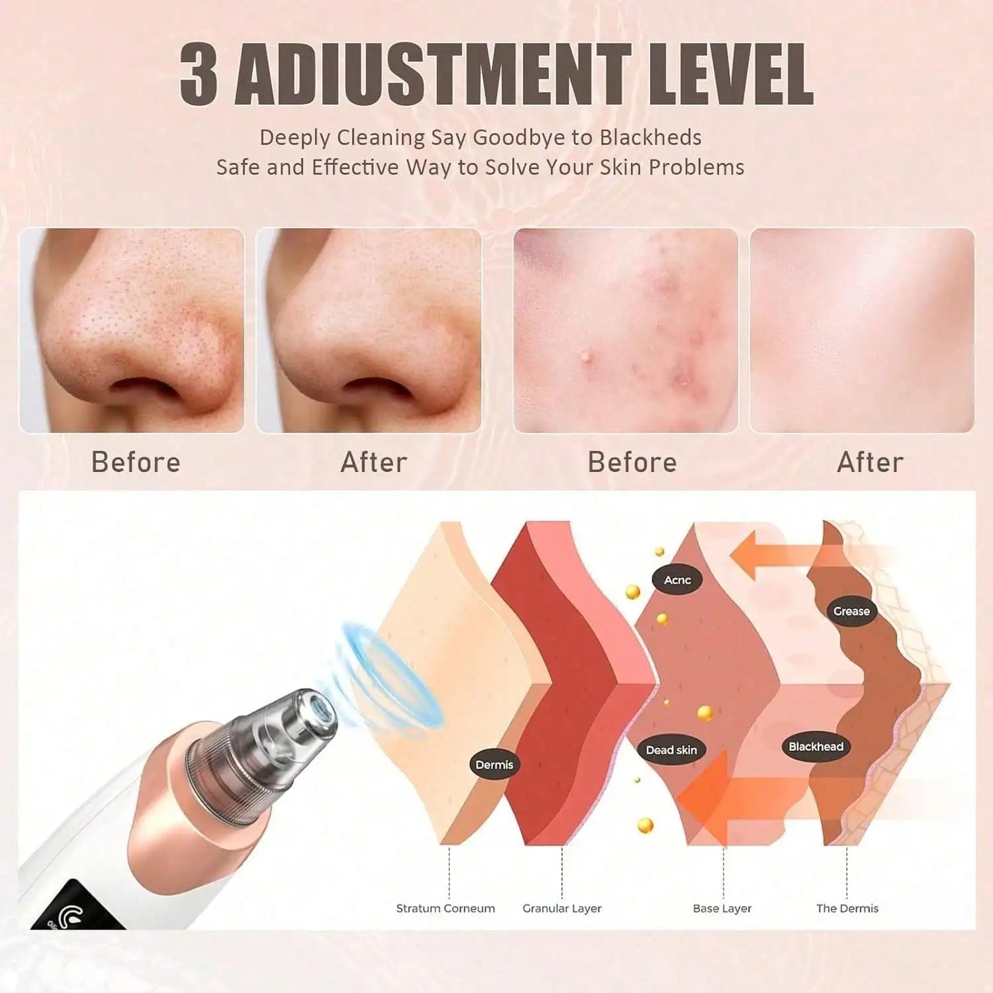 Advanced Professional Deep Pore Vacuum