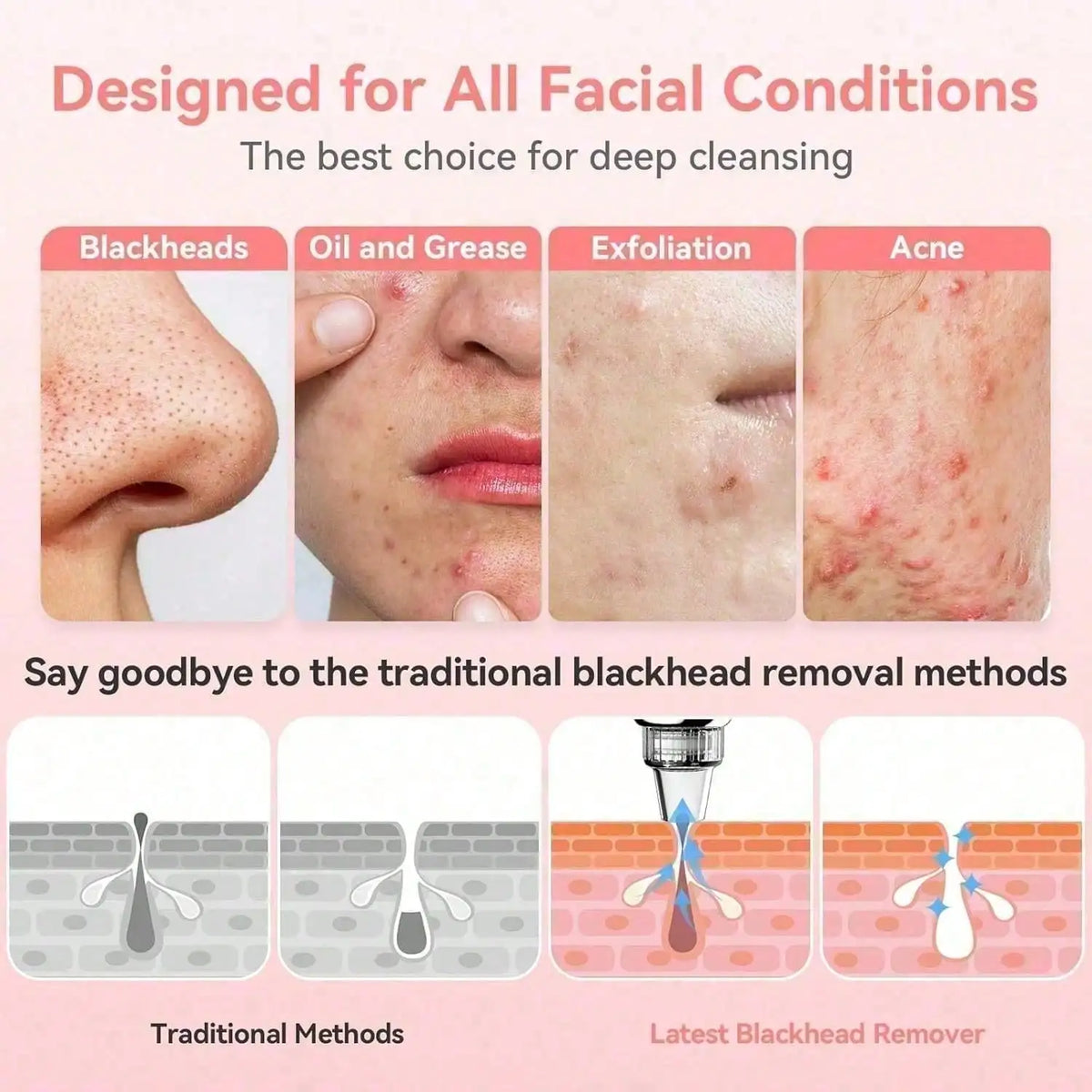 Advanced Professional Deep Pore Vacuum