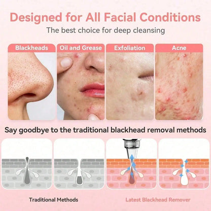 Advanced Professional Deep Pore Vacuum